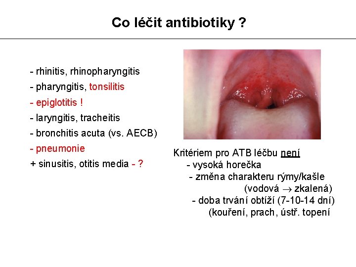Co léčit antibiotiky ? - rhinitis, rhinopharyngitis - pharyngitis, tonsilitis - epiglotitis ! -