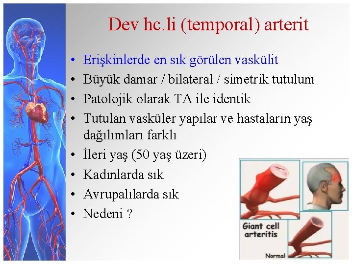 Dev hc. li (temporal) arterit • • Erişkinlerde en sık görülen vaskülit Büyük damar