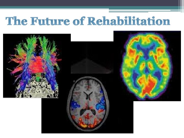 The Future of Rehabilitation 
