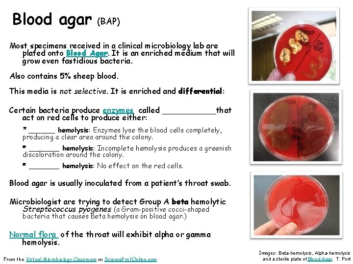 Blood agar (BAP) Most specimens received in a clinical microbiology lab are plated onto