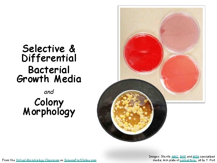Selective & Differential Bacterial Growth Media and Colony Morphology From the Virtual Microbiology Classroom