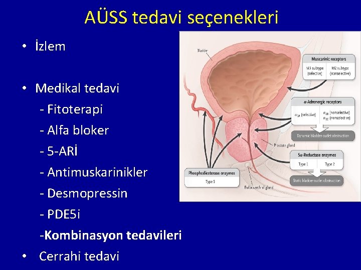 AÜSS tedavi seçenekleri • İzlem • Medikal tedavi - Fitoterapi - Alfa bloker -