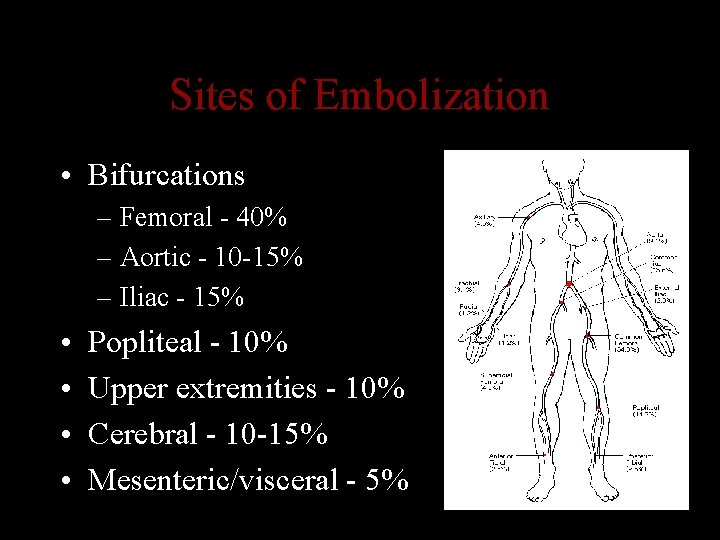 Sites of Embolization • Bifurcations – Femoral - 40% – Aortic - 10 -15%