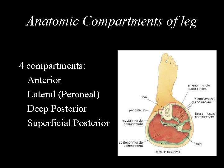 Anatomic Compartments of leg 4 compartments: Anterior Lateral (Peroneal) Deep Posterior Superficial Posterior 