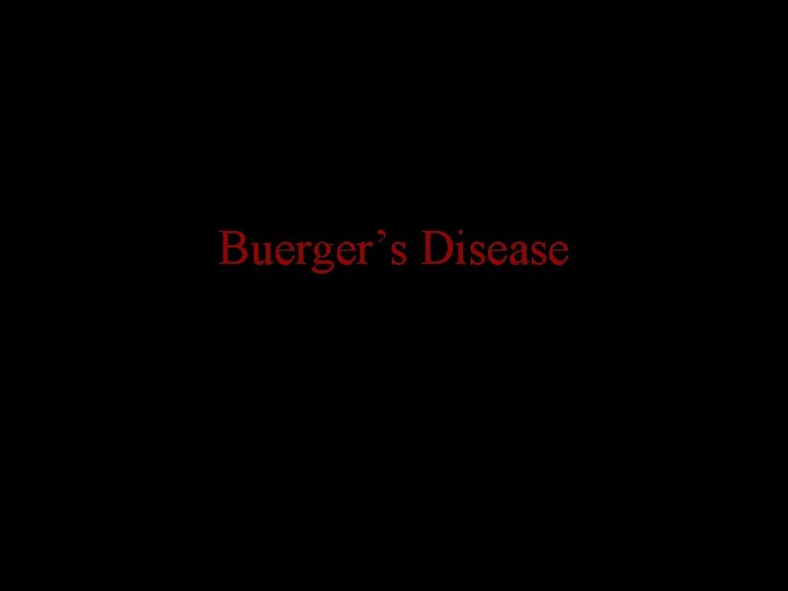 Buerger’s Disease 