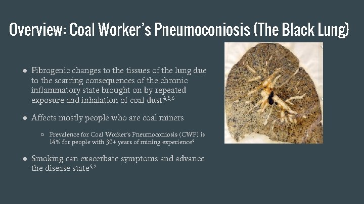 Overview: Coal Worker’s Pneumoconiosis (The Black Lung) ● Fibrogenic changes to the tissues of