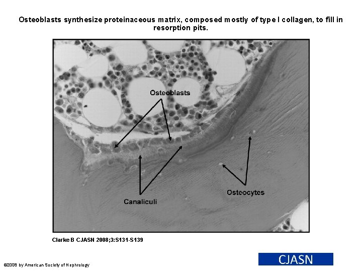 Osteoblasts synthesize proteinaceous matrix, composed mostly of type I collagen, to fill in resorption