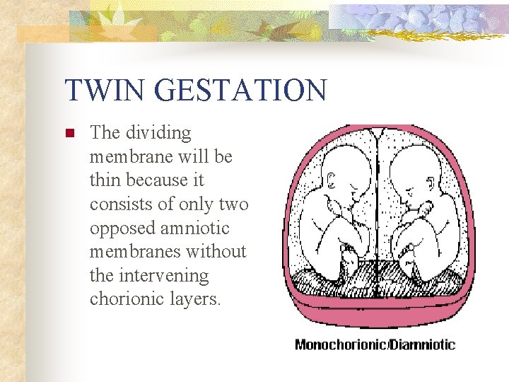 TWIN GESTATION n The dividing membrane will be thin because it consists of only