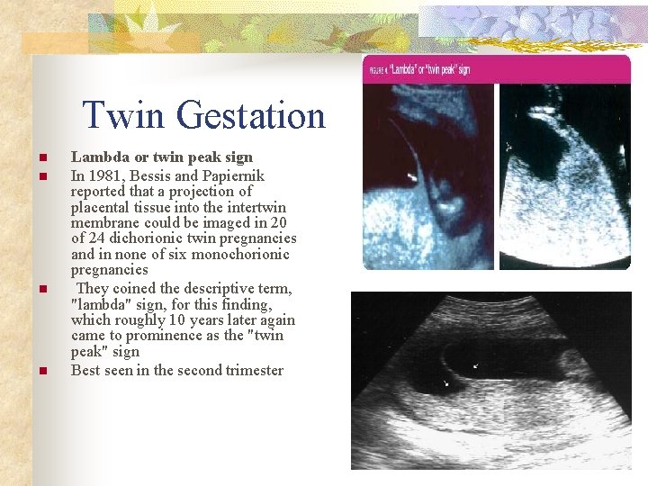 Twin Gestation n n Lambda or twin peak sign In 1981, Bessis and Papiernik