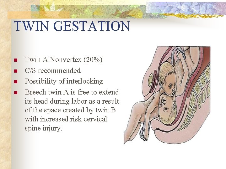 TWIN GESTATION n n Twin A Nonvertex (20%) C/S recommended Possibility of interlocking Breech