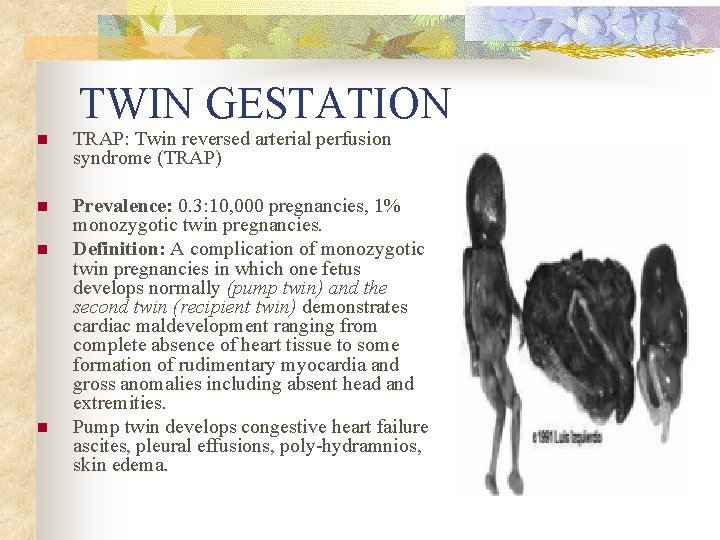 TWIN GESTATION n TRAP: Twin reversed arterial perfusion syndrome (TRAP) n Prevalence: 0. 3: