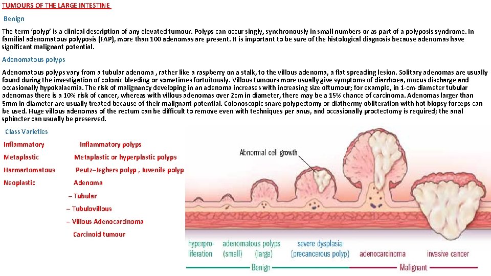 TUMOURS OF THE LARGE INTESTINE Benign The term ‘polyp’ is a clinical description of