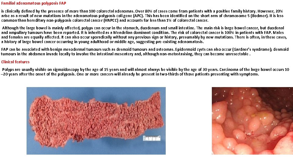 Familial adenomatous polyposis FAP is clinically deﬁned by the presence of more than 100