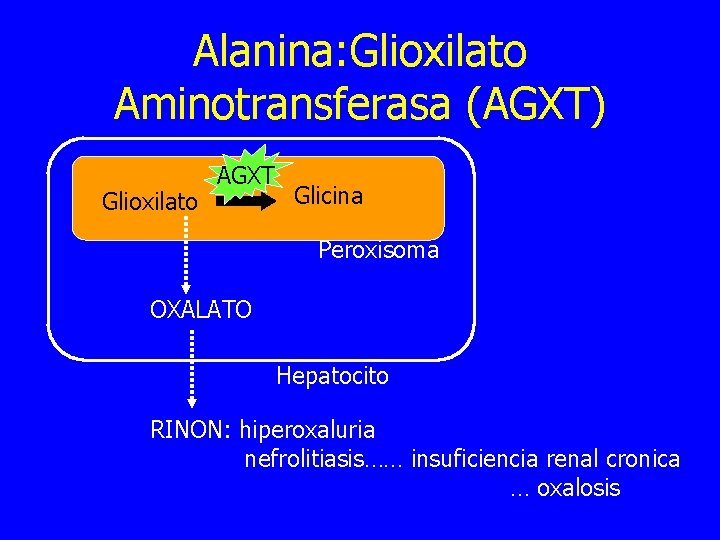 Alanina: Glioxilato Aminotransferasa (AGXT) Glioxilato AGXT Glicina Peroxisoma OXALATO Hepatocito RINON: hiperoxaluria nefrolitiasis…… insuficiencia