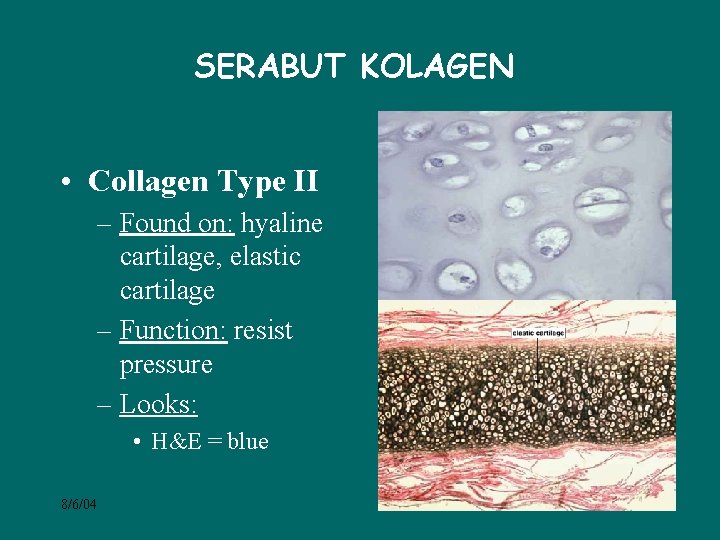 SERABUT KOLAGEN • Collagen Type II – Found on: hyaline cartilage, elastic cartilage –