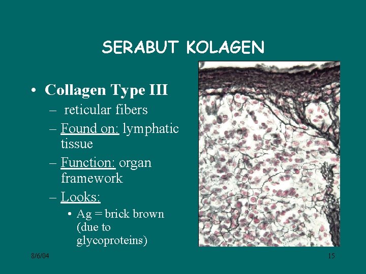 SERABUT KOLAGEN • Collagen Type III – reticular fibers – Found on: lymphatic tissue