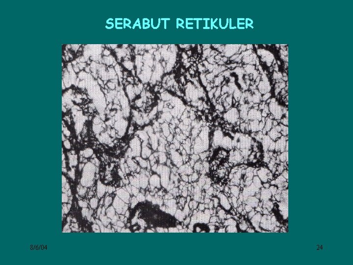 SERABUT RETIKULER 8/6/04 24 