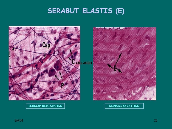 SERABUT ELASTIS (E) OLLAGEN SEDIAAN RENTANG H. E 8/6/04 SEDIAAN SAYAT H. E 26