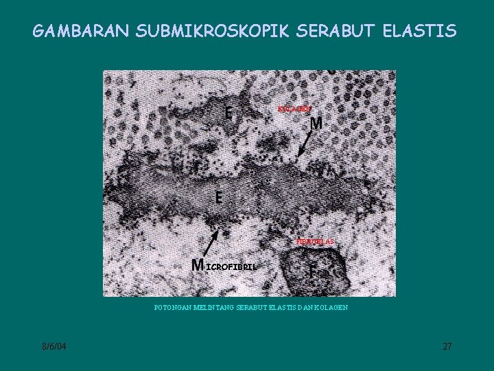 GAMBARAN SUBMIKROSKOPIK SERABUT ELASTIS KOLAGEN FIBROBLAS ICROFIBRIL POTONGAN MELINTANG SERABUT ELASTIS DAN KOLAGEN 8/6/04