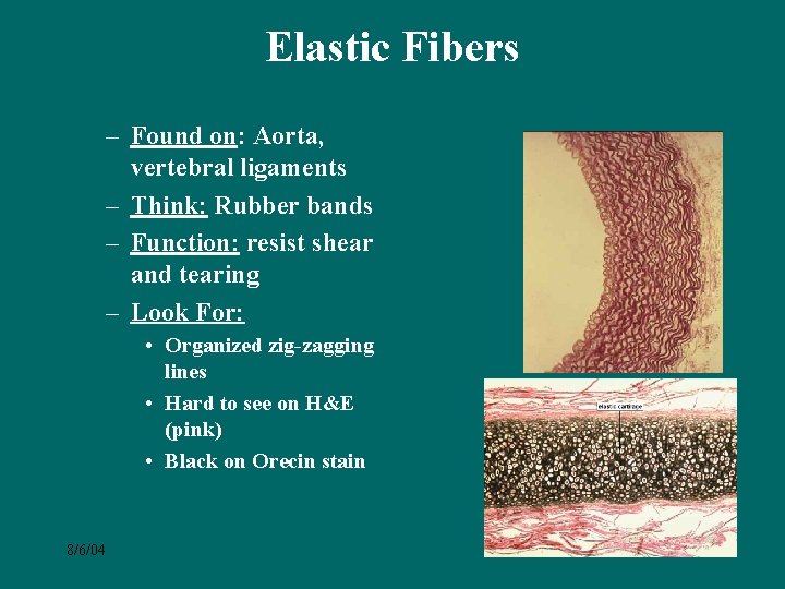 Elastic Fibers – Found on: Aorta, vertebral ligaments – Think: Rubber bands – Function: