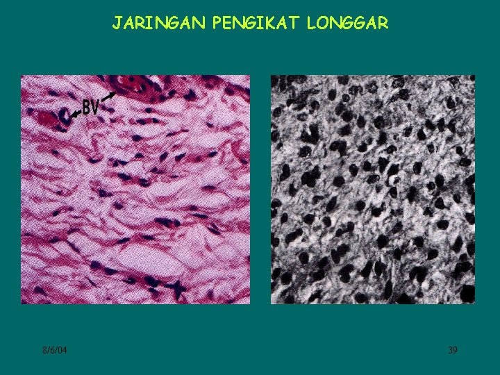 JARINGAN PENGIKAT LONGGAR 8/6/04 39 