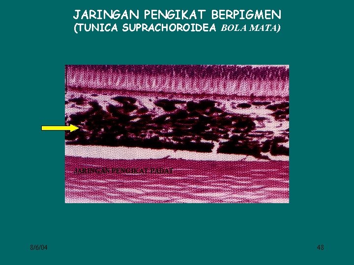 JARINGAN PENGIKAT BERPIGMEN (TUNICA SUPRACHOROIDEA BOLA MATA) JARINGAN PENGIKAT PADAT 8/6/04 48 