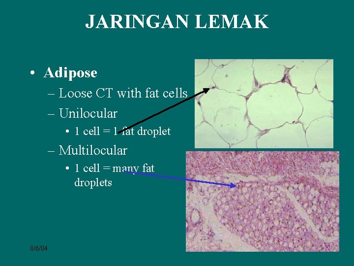 JARINGAN LEMAK • Adipose – Loose CT with fat cells – Unilocular • 1