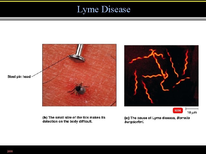 Lyme Disease 2008 Figure 23. 13 b, c 