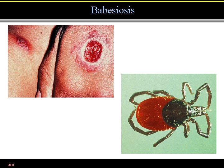 Babesiosis 2008 Figure 12. 32 