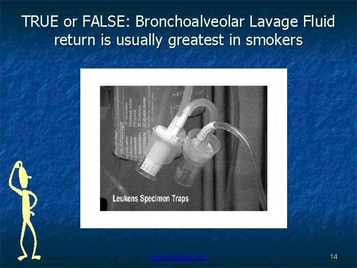 TRUE or FALSE: Bronchoalveolar Lavage Fluid return is usually greatest in smokers bronchoscopy. org