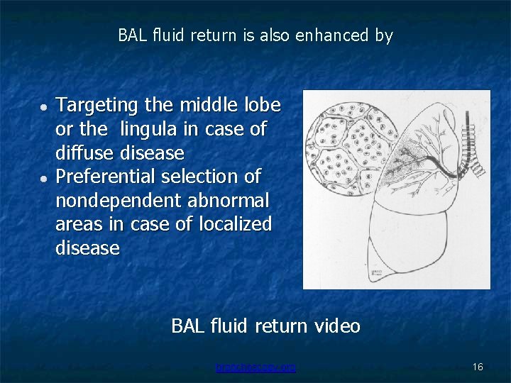 BAL fluid return is also enhanced by Targeting the middle lobe or the lingula