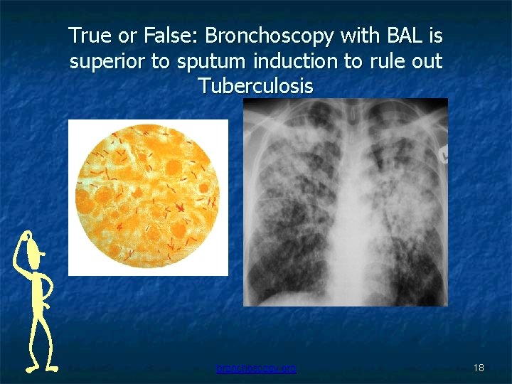 True or False: Bronchoscopy with BAL is superior to sputum induction to rule out