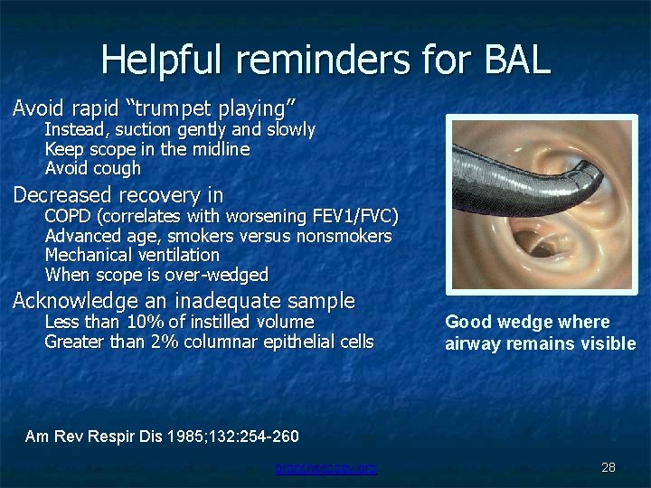 Helpful reminders for BAL Avoid rapid “trumpet playing” Instead, suction gently and slowly Keep