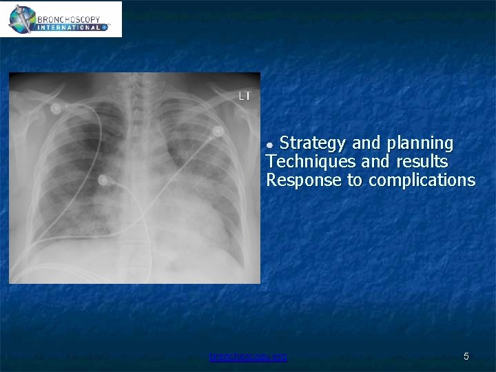 Strategy and planning Techniques and results Response to complications bronchoscopy. org 5 