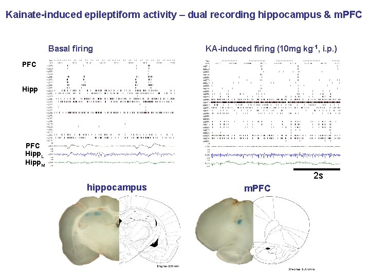 Kainate-induced epileptiform activity – dual recording hippocampus & m. PFC Basal firing KA-induced firing