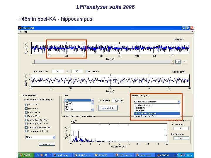 LFPanalyser suite 2006 • 45 min post-KA - hippocampus 