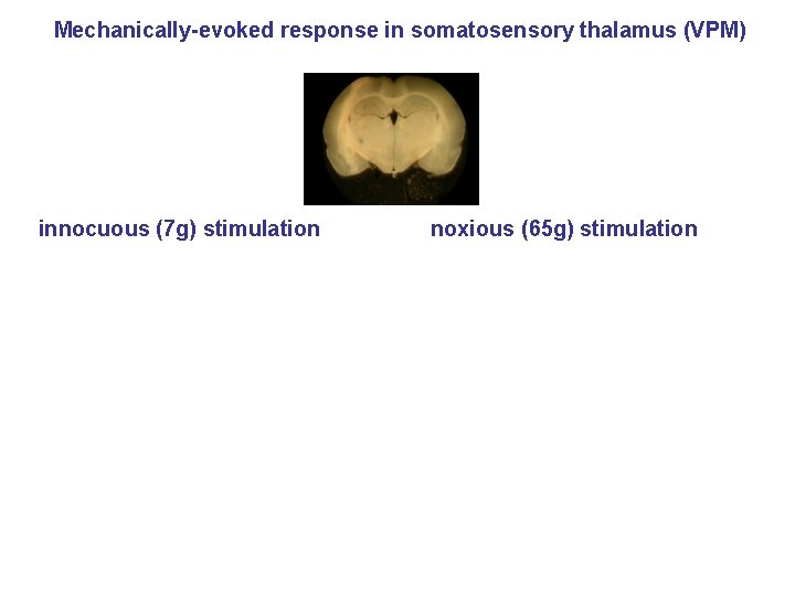 Mechanically-evoked response in somatosensory thalamus (VPM) innocuous (7 g) stimulation noxious (65 g) stimulation