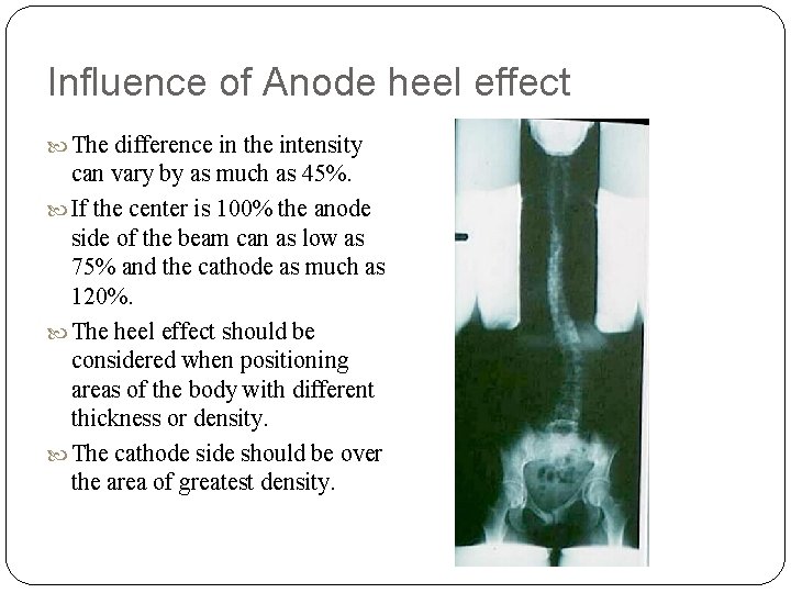 Influence of Anode heel effect The difference in the intensity can vary by as Influence of Anode heel effect The difference in the intensity can vary by as