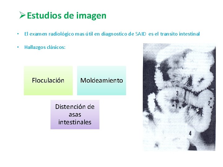 ØEstudios de imagen • El examen radiológico mas útil en diagnostico de SAID es