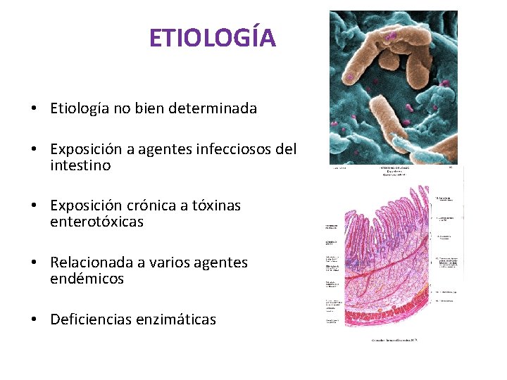 ETIOLOGÍA • Etiología no bien determinada • Exposición a agentes infecciosos del intestino •