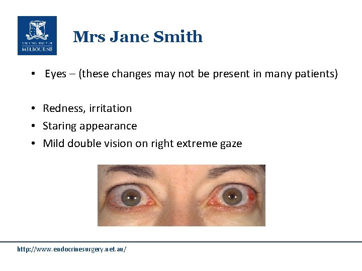 Mrs Jane Smith • Eyes – (these changes may not be present in many