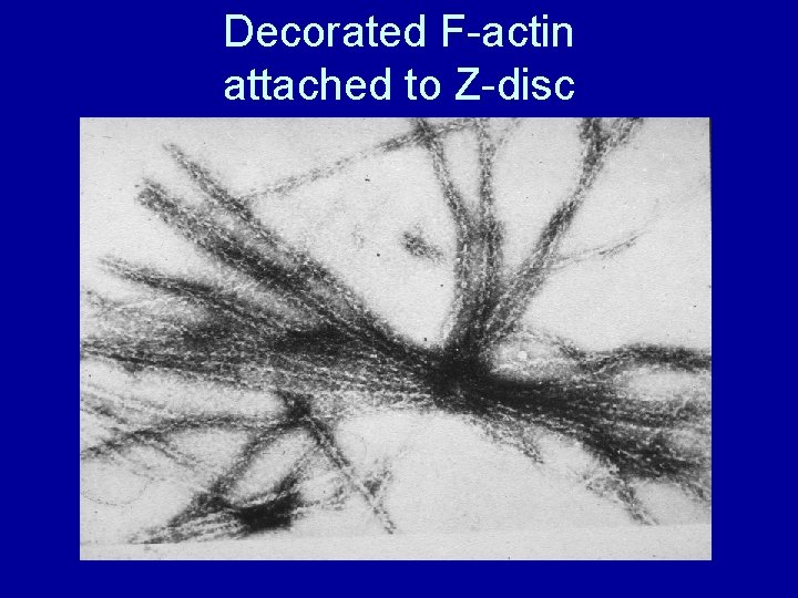 Decorated F-actin attached to Z-disc 