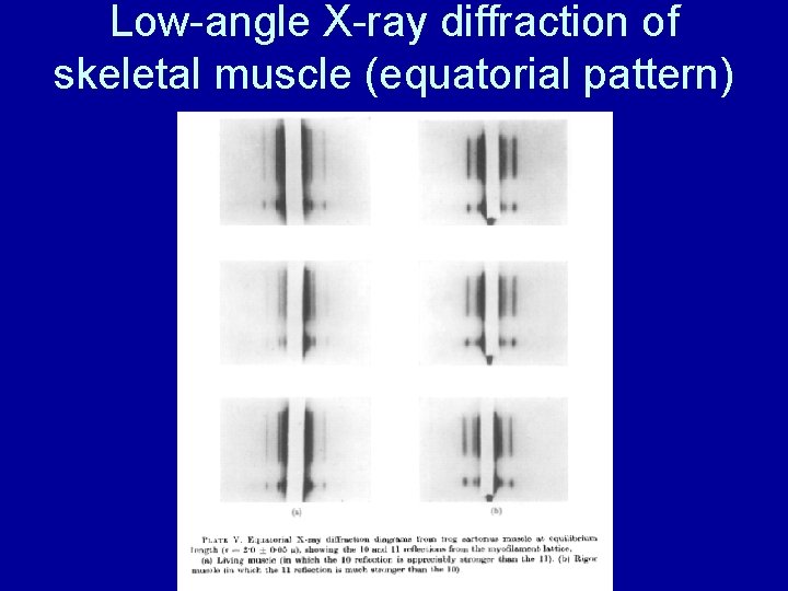 Low-angle X-ray diffraction of skeletal muscle (equatorial pattern) 