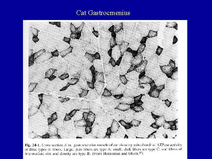 Cat Gastrocmenius 