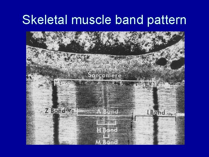 Skeletal muscle band pattern 