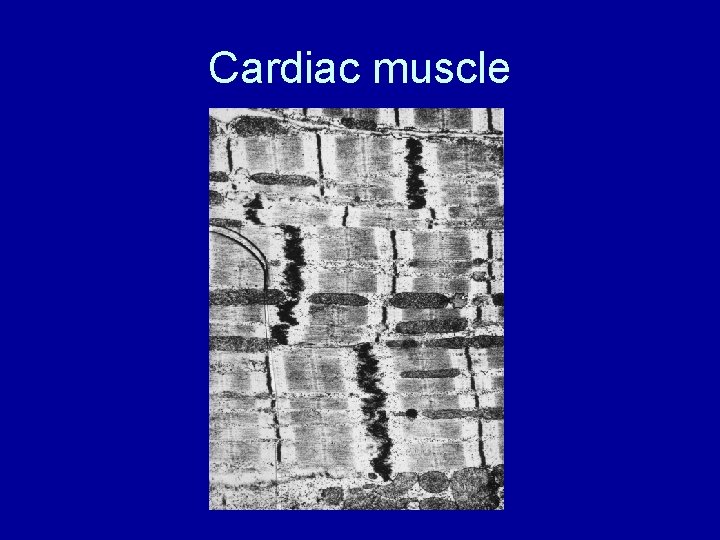 Cardiac muscle 