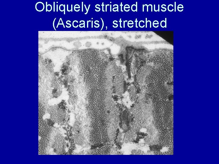 Obliquely striated muscle (Ascaris), stretched 