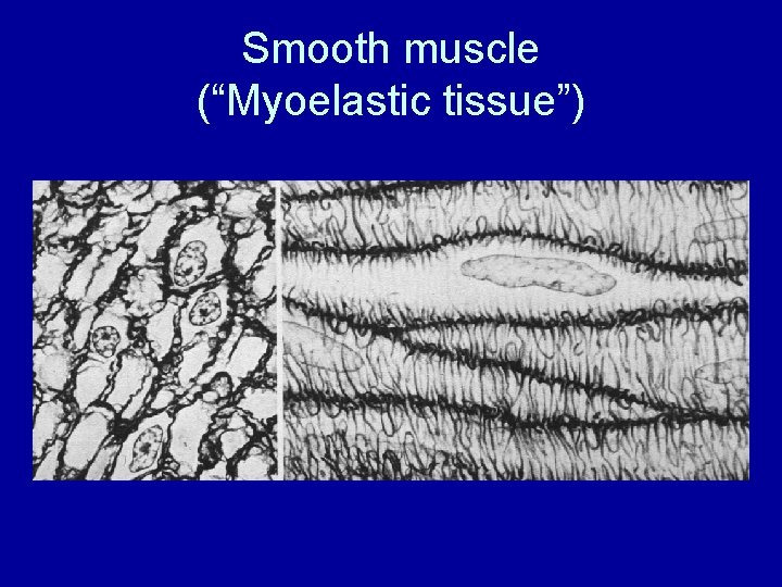 Smooth muscle (“Myoelastic tissue”) 