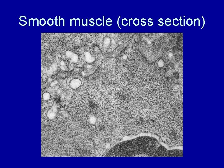 Smooth muscle (cross section) 