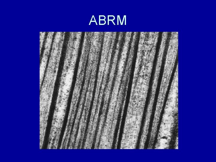 ABRM 